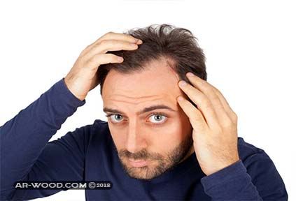 علاج تساقط الشعر الشديد بالقرأن